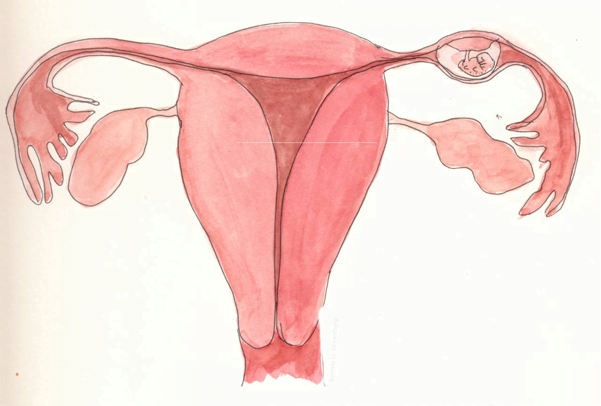 ماذا تعرف عن الحمل خارج الرحم 