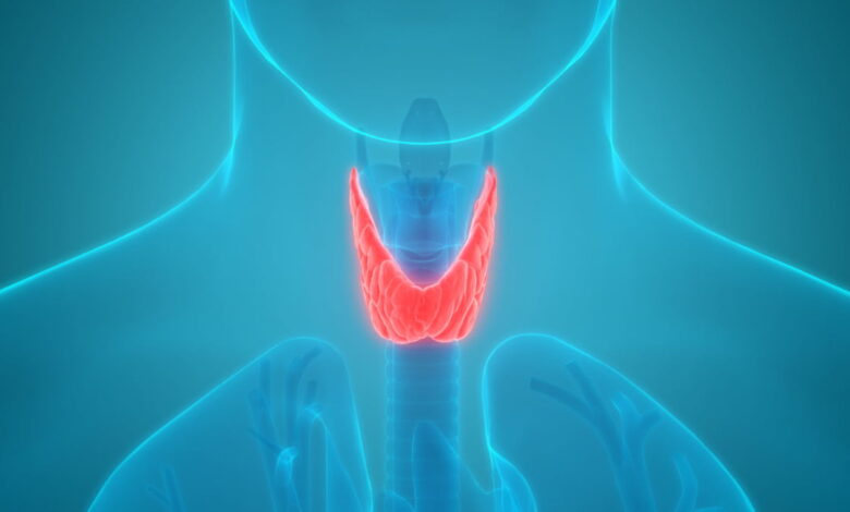 علاج فرط نشاط الغدة الدرقسة